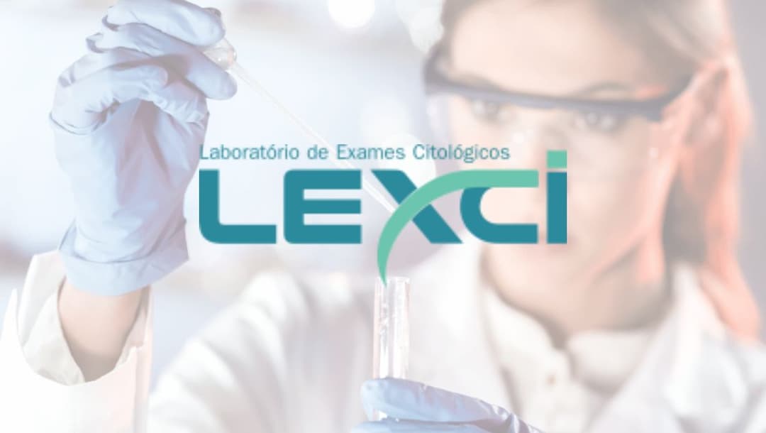 Lexci - Laboratorio